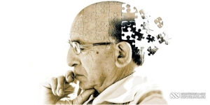 „ვიზუალური და სმენითი ჰალუცინაციები“ - რა სიმპტომები ახასიათებს ალცჰაიმერის დაავადბას