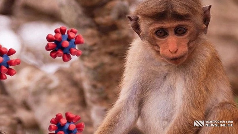 პანდემიის მორიგი სერია იწყება - საქართველოში მაიმუნის ყვავილის პირველი შემთხვვა დაფიქსირდა